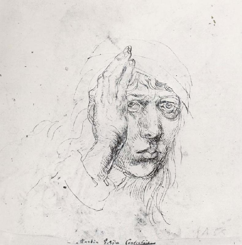 Albrecht Durer Sele-Portrait with Bandage oil painting image